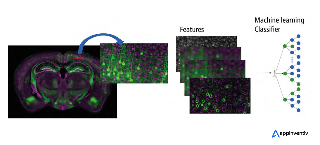 AI in Imageing Analysis