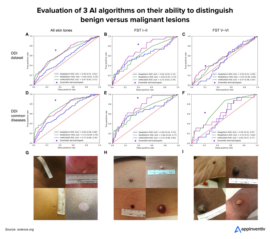  Evaluation of 3 AI algorithms on their ability to distinguish benign versus malignant lesions