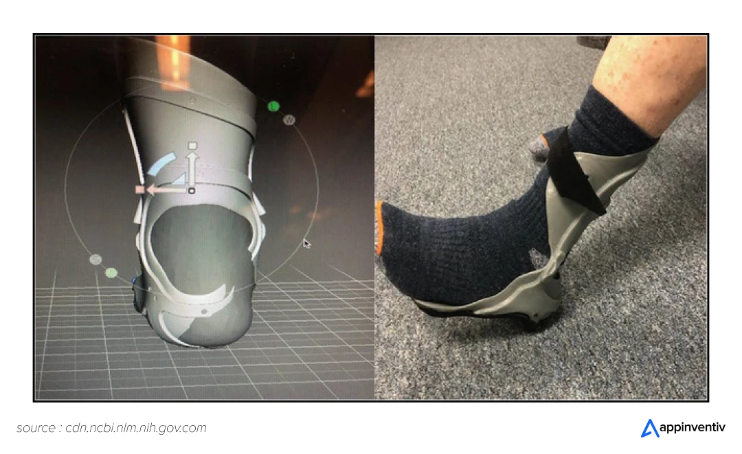 Designing ankle-foot orthosis through 3D printing.